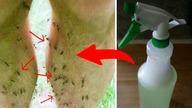 Komary i Inne Insekty To Zmora - Ta mikstura Sprawi, że Się Ich Pozbędziesz (100% Naturalnie)