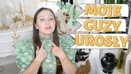 MOJE GUZY NA TARCZYCY UROSŁY CO TERAZ