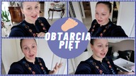 OBTARCIA PRZEZ BUTY JAK IM ZAPOBIEGAC