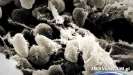 Dżuma w Chinach! Czy grozi nam epidemia?