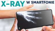 SMARTFON Z RENTGENEM? 