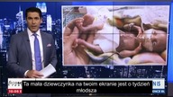 NewsMax | Rob Schmitt: Jak wygląda ślepa aborcja | Napisy PL