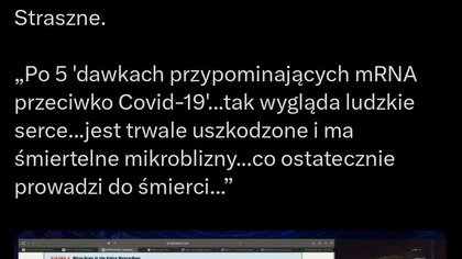 Szczepionka mRNA produkuje proteinę kolca w sercu powodując zapalenie, blizny i ostatecznie nagła śmierć na skutek zaburzenia pracy serca