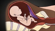 Nawrócony Aborcjonista mówi jak wygląda Aborcja - Abortion Literature Subject - BMS Pro Life