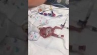 24 weeks from conception - Brooklen is only nine inches long an | 24 tydzień od poczęcia | Pro Life