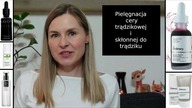 Pielęgnacja cery trądzikowej i skłonnej do trądziku | Kasia D