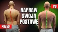 NAPRAW swoją POSTURĘ raz na Zawsze! Na przykładzie Jarka