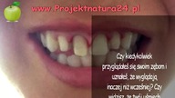 3 Naturalnie Sposoby Leczenia Cofających się Dziąseł