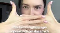 JA PO OPERACJI::