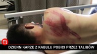 Dziennikarze z Kabulu zatrzymani i pobici przez talibów.