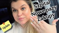 JAK WYGLĄDAJĄ MOJE BLIZNY?