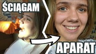 ŚCIĄGAM APARAT || wizyta + moja reakcja!