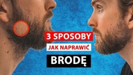 3 sposoby na dziury w zaroscie Jak to naprawic? | Series X