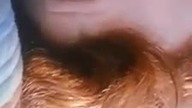 Voldemort na czole