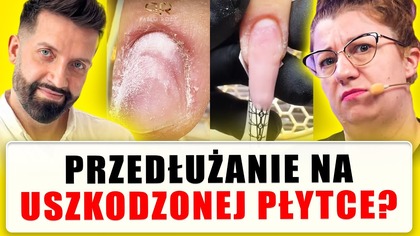 Czy Pablo Rozz podjął dobrą decyzję? | Quloo Lupa