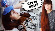Moje doświadczenia: MEZOTERAPIA MIKROIGŁOWA SKÓRY GŁOWY | Wypadanie włosów