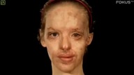 Katie Piper - odzyskać wzrok.  Dokument
