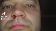 sędzia Anna Cieślar i Kawulok robią z niewinnego mężczyzny przestępcę.  Cieszyn bicie mężczyzn