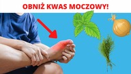 Obniż kwas moczowy tymi naturalnymi składnikami  Wystarczy 7 dni