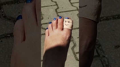 Magia uśmiechu  #shorts #humor #comedy #dc #fyp #zart #dziecko #przedszkolak #plaster #palec