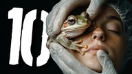 10 niebezpiecznych pseudonaukowych terapii [TOPOWA DYCHA]