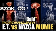 E. T.  vs NAZKA-MUMIE NIEDZIELNA ROZKMINA W CIEPŁY WIECZÓR IKSDE LOL (BaldTV) 
