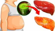 Masz Złe Samopoczucie? Więc Czas Na Detoks Wątroby!!!