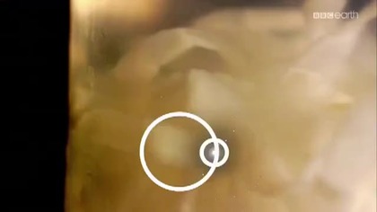 Michael Mosley i pasożyty (2014) [Lektor PL]