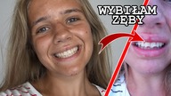 Jak ZŁAMAŁAM ZĘBY?