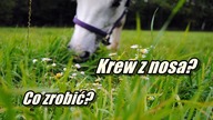 Krwawienie z nosa