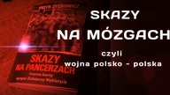 SKAZY NA MÓZGACH