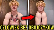 Urodził Się Bez Obojczyków i Może Klaskać Barkami