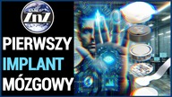 Pierwszy pacjent z wszczepionym chipem Neuralink odzyskuje zdrowie