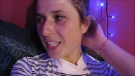 VLOG | DOCENIAM TO CO MAM | PORANIONE DŁONIE DO KRWI