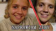 NAPRAWIAM ZĘBY!