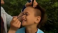 operacja jaszórki
