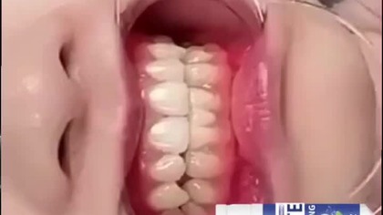 Proszek Wybielający Zęby #zęby #shortvideo #shorts