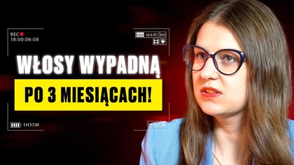 WŁOSY wypadają? Twój organizm już się PODDAJE! Ekspertka ostrzega!
