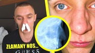 ZŁAMAŁEM NOS...  WIADNOMOŚĆ DO RYWALA
