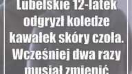 Lubelskie: 12-latek odgryzł koledze kawałek skóry czoła.  Wcześniej dwa razy musiał zmienić szkołę