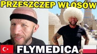Przeszczep Włosów Turcja - mój drugi zabieg z flymedica (Istambuł)