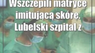 Wszczepili matrycę imitującą skórę.  Lubelski szpital z futurystyczną technologią