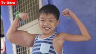 LiveLeak - Boy, 11, dubbed Popeye after mystery condition gives him huge biceps