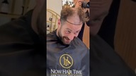 Chris Bumstead Przeszedł Przeszczep Włosów