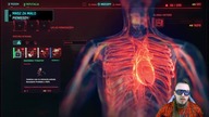 CYBERPUNK 2077#4 - Cyber wszczepy, nowe oczy i dłonie!