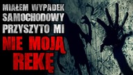 Miałem wypadek samochodowy, przyszyto mi nie moją rękę - Reddit CreepyPasta [Lektor PL]