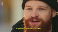 Czy brody są higieniczne?