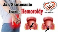 Jak Skutecznie Usunac Hemoroidy.  Aliaksand Haretski