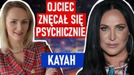 Ojciec uważał, że jest za brzydka, by być jego córką.  Czy naprawili okropne relacje? - Kayah