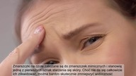 ZMARSZCZKI NA CZOLE - Pozbądź się ich tymi 3 domowymi sposobami!